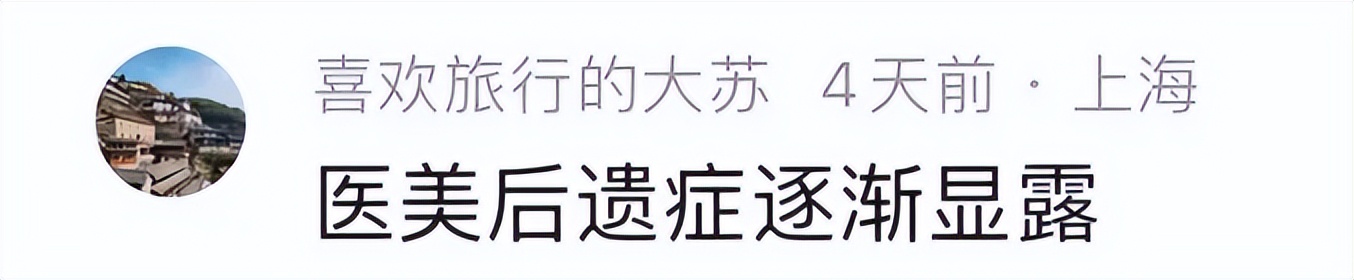 天啦，34岁张天爱怎么这么老了，像40多岁，网友辣评：医美后遗症  -图5